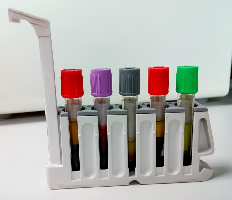 aplicaciones1_acidoetilendiaminotetraacetico